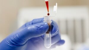 ВІЛ в Україні: скільки нових випадків зареєстрували у січні